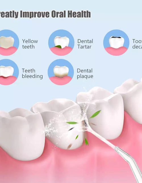 Load image into Gallery viewer, Waterproof Dental Cleaner
